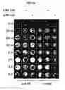 Fig. 11 - DERIVATION OF FIBROCHONDROCYTES FROM PROGENITOR CELLS