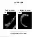 Fig. 21 - DERIVATION OF FIBROCHONDROCYTES FROM PROGENITOR CELLS