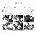 Fig. 22 - DERIVATION OF FIBROCHONDROCYTES FROM PROGENITOR CELLS