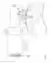 Fig. 02 - Suction apparatus for peritoneal cavity fluid perfusion system