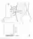 Fig. 05 - Suction apparatus for peritoneal cavity fluid perfusion system