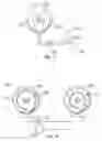 Fig. 12 - MASSAGING LACTATION ASSISTIVE DEVICE