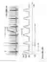 Fig. 05 - Physiologically responsive blood pump for ischemia detection and treatment