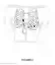 Fig. 06 - Physiologically responsive blood pump for ischemia detection and treatment