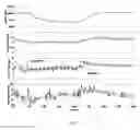 Fig. 13 - Smart tip LVAD inlet cannula