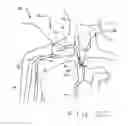 Fig. 07 - Methods to increase the overall diameter of donating veins and arteries