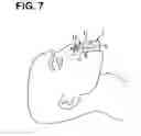 Fig. 07 - RESPIRATORY ASSISTANCE APPARATUS