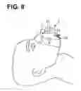 Fig. 08 - RESPIRATORY ASSISTANCE APPARATUS