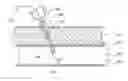 Fig. 01 - Sheathless guide catheter assembly