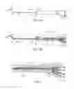 Fig. 04 - Sinus dilation catheter