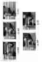 Fig. 53 - MRI and RF compatible leads and related methods of operating and fabricating leads