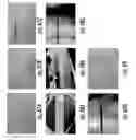 Fig. 55 - MRI and RF compatible leads and related methods of operating and fabricating leads
