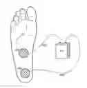 Fig. 01 - PROGRAMMABLE ELECTRICAL STIMULATION OF THE FOOT MUSCLES