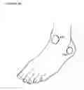 Fig. 14 - PROGRAMMABLE ELECTRICAL STIMULATION OF THE FOOT MUSCLES