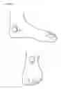 Fig. 15 - PROGRAMMABLE ELECTRICAL STIMULATION OF THE FOOT MUSCLES