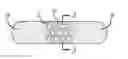 Fig. 01 - Methods and devices for surgical pre-treatment