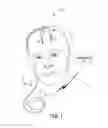 Fig. 02 - Brain stimulation therapy