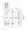 Fig. 03 - Brain stimulation therapy