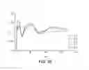 Fig. 10 - Brain stimulation therapy