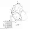 Fig. 02 - Rate responsive cardiac pacing control using posture