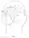 Fig. 07 - Implantable head located radiofrequency coupled neurostimulation system for head pain