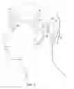 Fig. 08 - Implantable head located radiofrequency coupled neurostimulation system for head pain