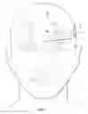 Fig. 09 - Implantable head located radiofrequency coupled neurostimulation system for head pain