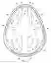 Fig. 35 - Implantable head located radiofrequency coupled neurostimulation system for head pain