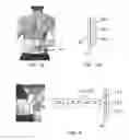 Fig. 03 - Phototherapy device with pain location input