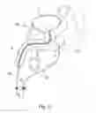 Fig. 10 - SYSTEM TO PRODUCE ANATOMICAL REPRODUCIBILITY AND DETECT MOTION DURING A MEDICAL TREATMENT AND METHODS OF USE