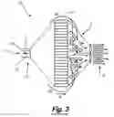 Fig. 04 - Air cleaning device and apparatus