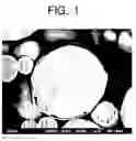 Fig. 02 - Metal composite powder and method for producing same