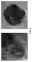 Fig. 09 - Multilayered metal nano and micron particles