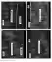 Fig. 12 - Multilayered metal nano and micron particles