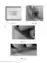 Fig. 08 - LAMINATING THIN GLASS STRUCTURES