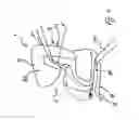 Fig. 02 - RESTRAINING ELEMENT