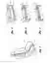 Fig. 02 - Layered seating system with attachments