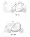 Fig. 21 - Moveable internal shock-absorbing energy dissipation padding in an autonomous vehicle
