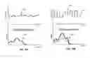 Fig. 19 - Multi-function speed sensor