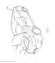 Fig. 02 - Engine cover grommets and methods