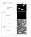 Fig. 15 - Solabegron zwitterion and uses thereof