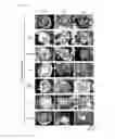Fig. 03 - Culture medium for pluripotent stem cells