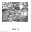 Fig. 04 - Proliferative primary human Sertoli cell cultures and their applications