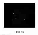 Fig. 16 - Methods for making and using modified oocytes