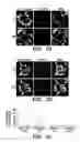 Fig. 07 - Method for treating kidney disease with a SLIT2-binding extracellular domain of ROBO2