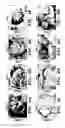 Fig. 09 - Method for treating kidney disease with a SLIT2-binding extracellular domain of ROBO2