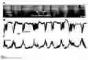 Fig. 03 - Method for selection of agents influencing intestinal motility disorders and pain