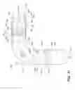 Fig. 12 - Turbine engine and particle separators therefore
