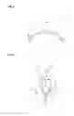 Fig. 03 - Brake shoe