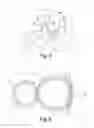 Fig. 04 - MONODIRECTIONALLY TORQUE-TRANSMITTING TOOTHED GEARING